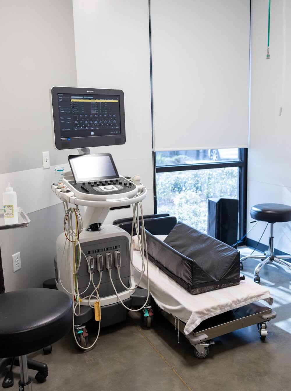 echocardio machine