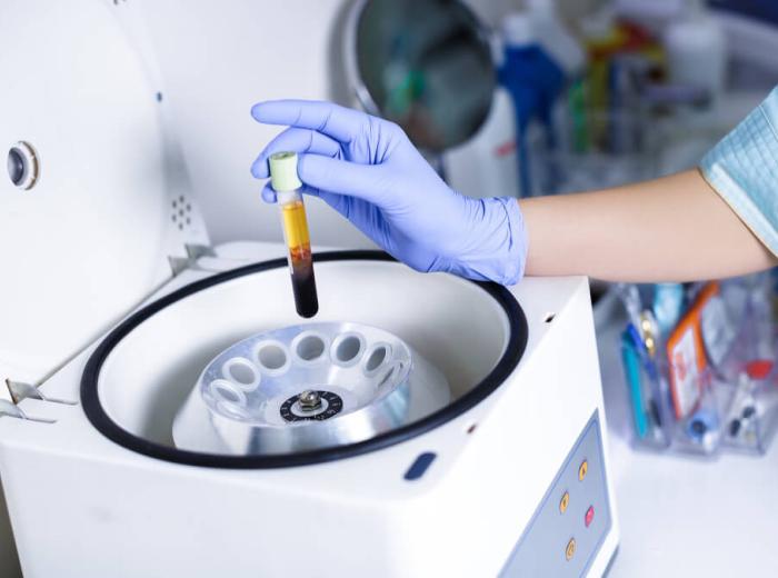 PRP Therapy: What Is It?